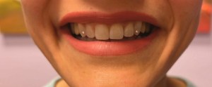 Tooth Gems