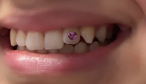 Tooth Gems