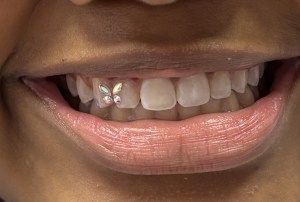 Tooth Gems