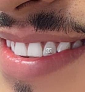 Tooth Gems